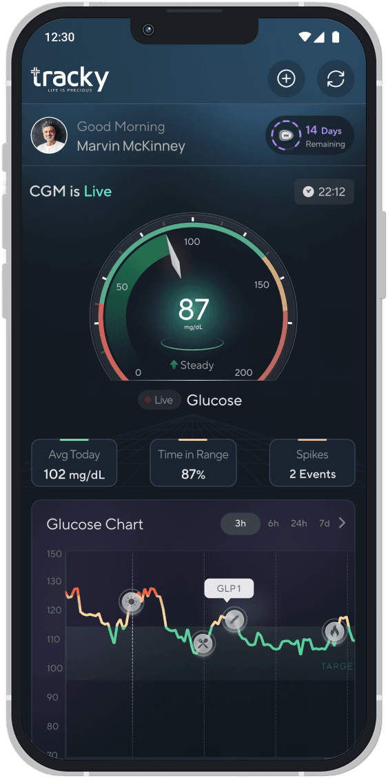 Continuous Glucose Monitoring