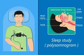 Sleep Test In Delhi